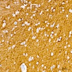 KD-Validated βIII-Tubulin Mouse mAb (20 μl)