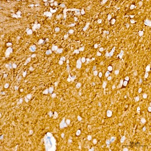 KD-Validated βIII-Tubulin Mouse mAb (20 μl)