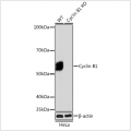 KO-Validated Cyclin B1 Rabbit mAb (20 μl)