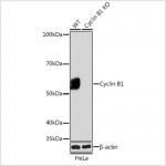 KO-Validated Cyclin B1 Rabbit mAb (20 μl)