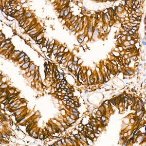 KO-Validated Integrin alpha 2 (ITGA2/CD49b) Rabbit mAb (20 μl)