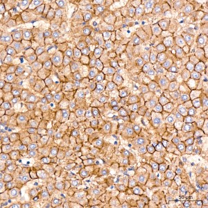 KO-Validated N-Cadherin Rabbit mAb (20 μl)