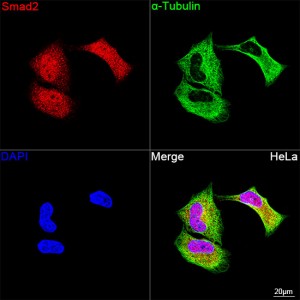 KD-Validated Smad2 Rabbit mAb (20 μl)