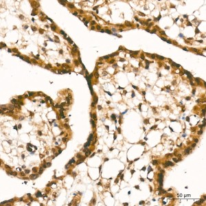 KO-Validated Smad4 Rabbit mAb (20 μl)