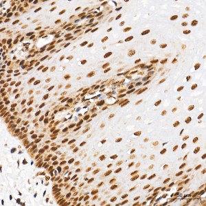 KO-Validated SUMO1 Rabbit mAb (20 μl)