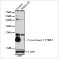 KO-Validated Peroxiredoxin 2 (PRDX2) Rabbit pAb (20 μl)
