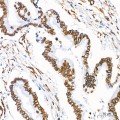 KO-Validated Lamin A/C Rabbit mAb (20 μl)