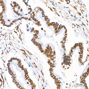 KO-Validated Lamin A/C Rabbit mAb (20 μl)
