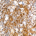 KO-Validated STAT3 Rabbit mAb (20 μl)