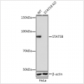 KO-Validated STAT5B Rabbit mAb (20 μl)