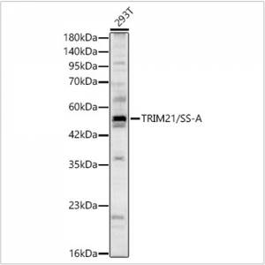 KD-Validated TRIM21/SS-A Rabbit pAb (20 μl)