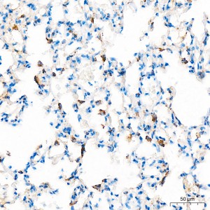 KO-Validated SOD2 Rabbit mAb (20 μl)