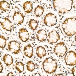 KO-Validated HuR/ELAVL1 Rabbit mAb (20 μl)