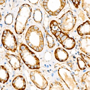 KO-Validated β-Catenin Rabbit mAb (20 μl)