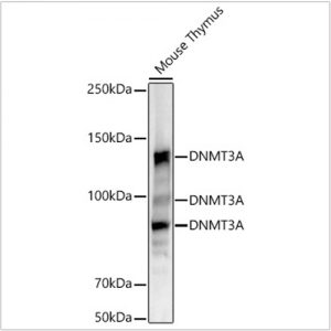 KO-Validated DNMT3A Rabbit mAb (20 μl)