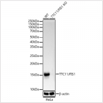 KO-Validated TTC11/FIS1 Rabbit mAb (20 μl)