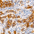KO-Validated ATG5 Rabbit mAb (20 μl)