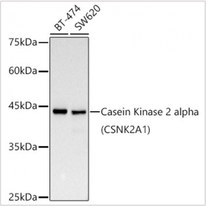 KD-Validated Casein Kinase 2 alpha (CSNK2A1) Rabbit mAb (20 μl)
