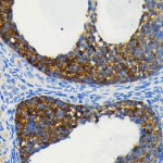 KO-Validated cIAP1 Rabbit mAb (20 μl)