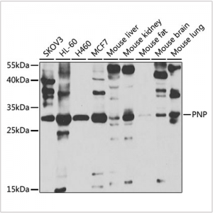 KO-Validated PNP Rabbit pAb (20 μl)