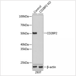 KO-Validated CD2BP2 Rabbit pAb (20 μl)