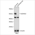 KO-Validated ALDH3A2 Rabbit pAb (20 μl)