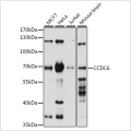 KO-Validated CCDC6 Rabbit pAb (20 μl)