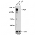 KO-Validated IPO4 Rabbit pAb (20 μl)