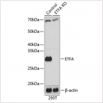 KO-Validated ETFA Rabbit pAb (20 μl)