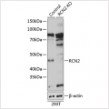 KO-Validated RCN2 Rabbit pAb (20 μl)