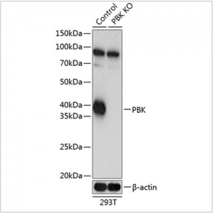 KO-Validated SPK Rabbit pAb (20 μl)