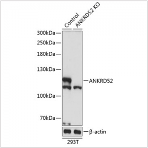 KO-Validated ANKRD52 Rabbit pAb (20 μl)