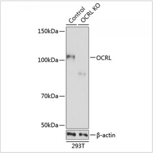KO-Validated OCRL Rabbit pAb (20 μl)