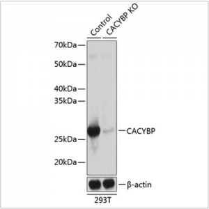 KO-Validated CACYBP Rabbit pAb (20 μl)