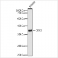 KD-Validated CDX2 Rabbit mAb (20 μl)