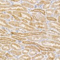 KO-Validated SIRT3 Rabbit mAb (20 μl)
