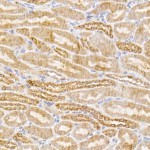 KO-Validated SIRT3 Rabbit mAb (20 μl)