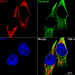 KO-Validated SLC25A4/ANT1 Rabbit mAb (20 μl)