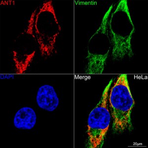 KO-Validated SLC25A4/ANT1 Rabbit mAb (20 μl)