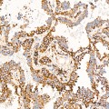 KD-Validated Calreticulin Rabbit mAb (20 μl)