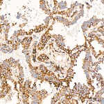 KD-Validated Calreticulin Rabbit mAb (20 μl)