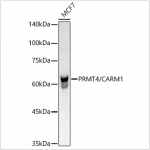 KO-Validated PRMT4/CARM1 Rabbit mAb (20 μl)