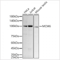 KD-Validated MCM6 Rabbit mAb (20 μl)