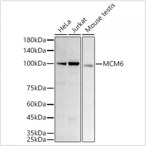 KD-Validated MCM6 Rabbit mAb (20 μl)