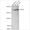 KD-Validated ABCA6 Rabbit pAb (20 μl)