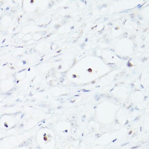 KO-Validated MSH6 Rabbit pAb (20 μl)