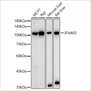 KO-Validated IFNAR2 Rabbit pAb (20 μl)