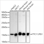 KO-Validated TTC11/FIS1 Rabbit pAb (20 μl)