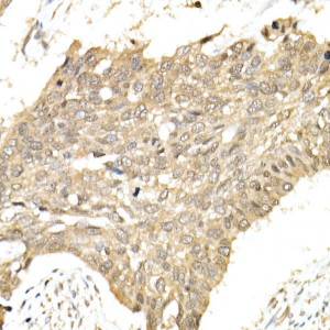 KO-Validated hnRNP E1/PCBP1 Rabbit pAb (20 μl)