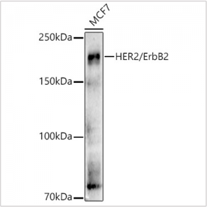 KO-Validated HER2/ErbB2 Rabbit pAb (20 μl)